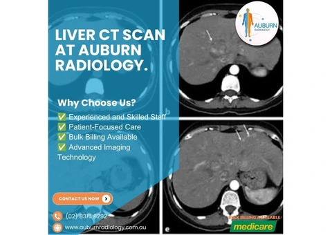 Liver CT Scan at Auburn Radiology. (02) 8315 8292