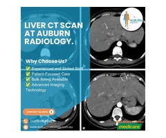 Liver CT Scan at Auburn Radiology. (02) 8315 8292