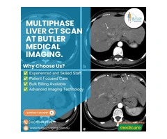 Multiphase Liver CT Scan at Butler Medical Imaging. (08) 9544 3999