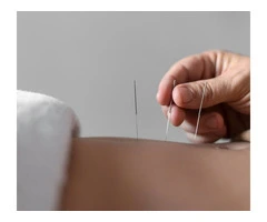 Is Dry Needling the Solution for Muscle Tightness?