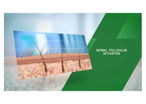 Do You Need a Good Hair Treatment Option in Sydney?