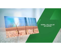 Do You Need a Good Hair Treatment Option in Sydney?