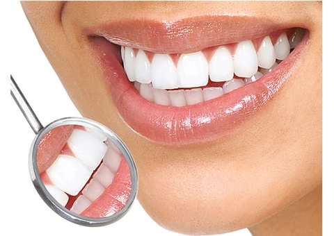 Composite Veneers Sydney - Bondi Dental Clinic Sydney