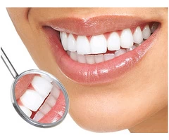 Composite Veneers Sydney - Bondi Dental Clinic Sydney