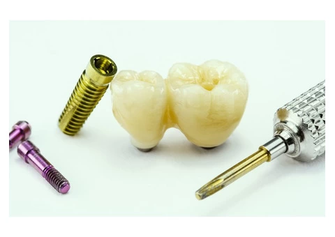 Dental Implants Cost Melbourne - Toothpals Dental Care
