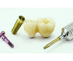 Dental Implants Cost Melbourne - Toothpals Dental Care