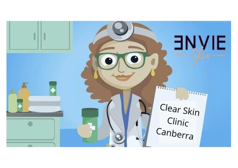 Canberra Mole Removal | Envieskin