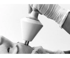 Wrinkle Reduction Treatment Coogee