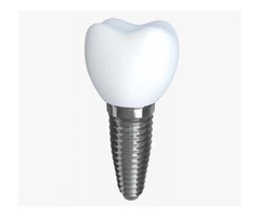 Get Best teeth implants in Melbourne | Prahran Family Dental