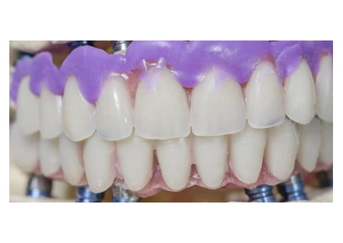 Get Best teeth implants in Melbourne | Prahran Family Dental - 2/3