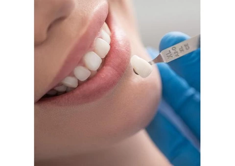 Dental crowns and caps Adelaide