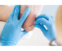 Call Bay Podiatry Clinic - For Happy Feet!!