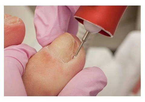 Call Bay Podiatry Clinic - For Happy Feet!! - 3/3