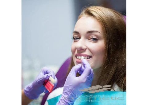 Affordable teeth caps In adelaide