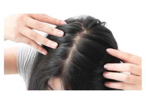 Looking for Natural Hair Loss Treatment?
