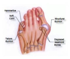 Manly Podiatrist | Podiatrist Manly | Podiatry Services