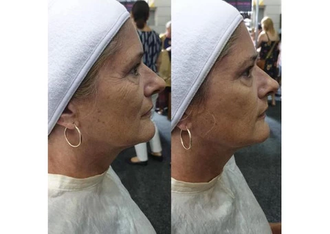 Are You Dreaming Of A Younger and Gorgeous Skin? - 3/7