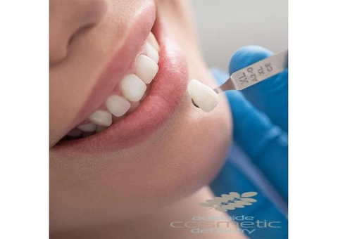 Dental Crowns and Bridges in adelaide