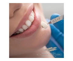 Dental Crowns and Bridges in adelaide
