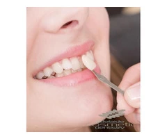 Affordable teeth capping in adelaide