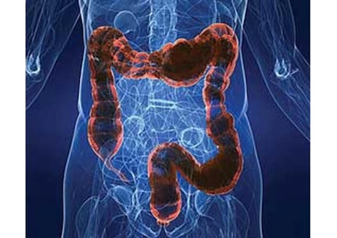 Colon Cleanse Clinic in Sydney