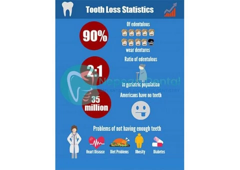 All On 4 Dental Implants Sydney | Best Implant Dentist In Sydney - 4/4