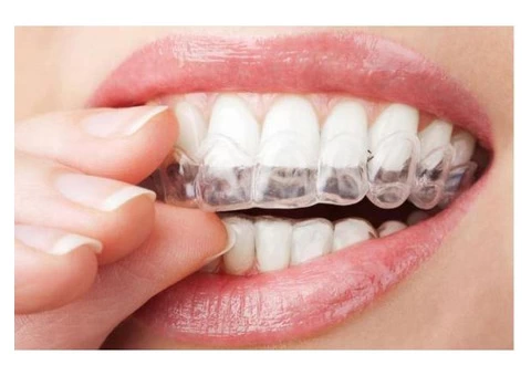 Invisalign Braces Adelaide