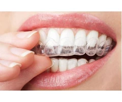 Invisalign Braces Adelaide