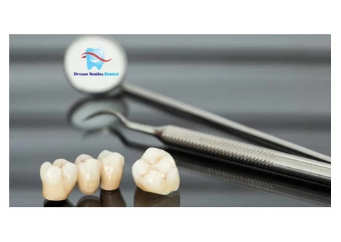 Porcelain Dental Veneers at Attractive Prices | Dream Smiles Dental