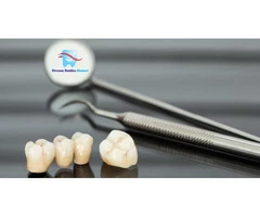 Porcelain Dental Veneers at Attractive Prices | Dream Smiles Dental