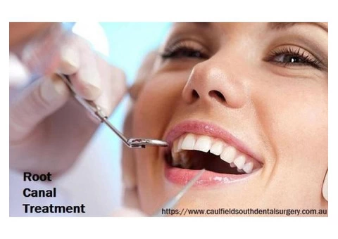 Save Your Teeth with Root Canal Treatment in Melbourne