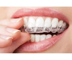 Bupa Dentist Near Me