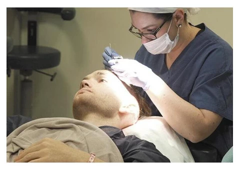 Best Hair Transplant Cost in Melbourne - 3/8