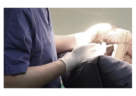 Best Hair Transplant Cost in Melbourne - 6/8