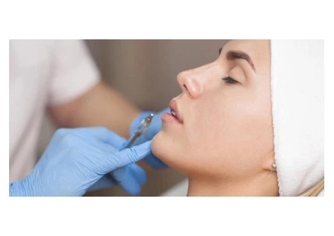 Lip Fillers Adelaide