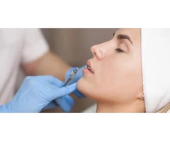 Lip Fillers Adelaide