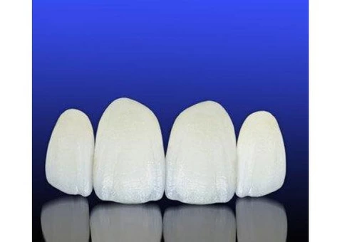 Best Porcelain Veneers in Melbourne | Prahran Family Dental - 2/2