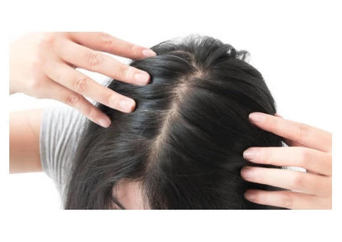 Losing Your Self Confidence Due to Female Hair Loss