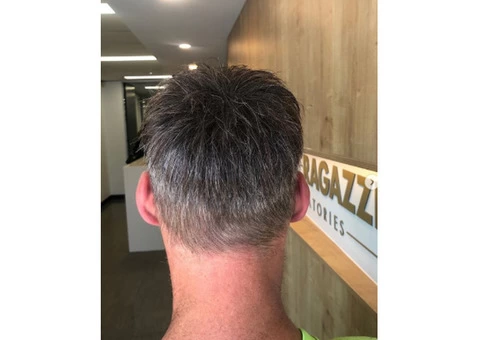 Trichologist Melbourne - 2/6