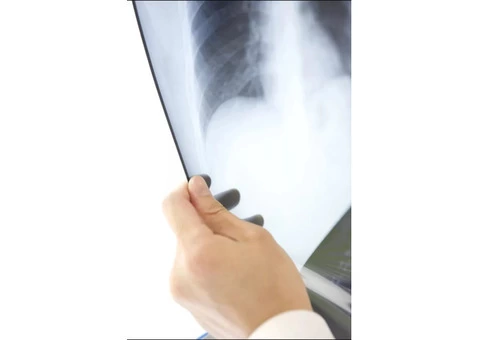 THE GONSTEAD CHIROPRACTIC SYSTEM - Caulfield Family Chiropractic - 3/3