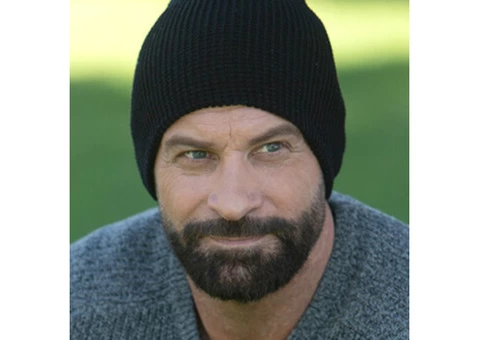 Best Beard Transplant Clinic - 2/6