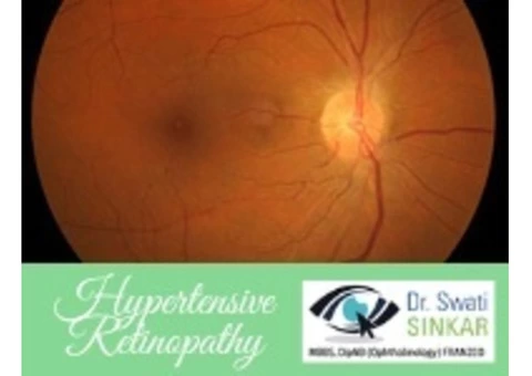 How Does Hypertensive Retinopathy Affect Your Vision | Dr. Swati Sinkar