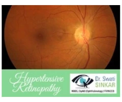 How Does Hypertensive Retinopathy Affect Your Vision | Dr. Swati Sinkar