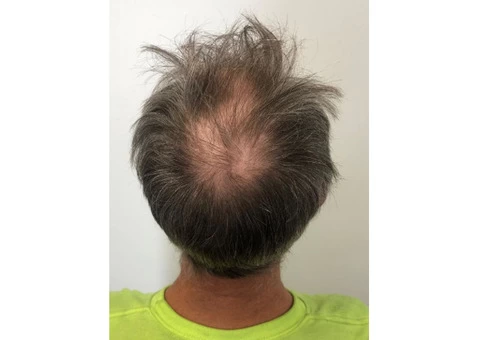 Best Trichologist Melbourne - 3/6