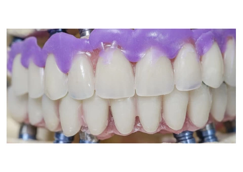 Best Teeth Implant dentistry treatment | Prahran Family Dental - 2/2