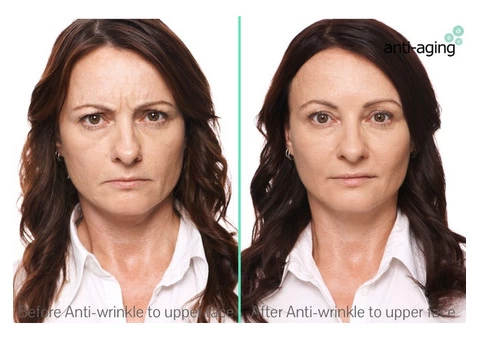 Looking for the treatment of strech marks in melbourne - 2/4