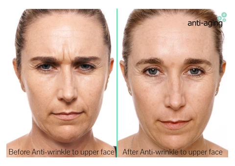 Looking for the treatment of strech marks in melbourne - 3/4