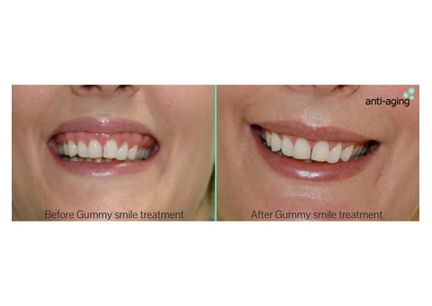 Looking for the treatment of strech marks in melbourne - 4/4