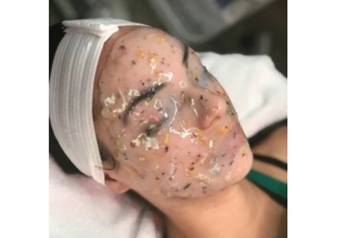 Skin Clinic Drouin - Ultimate Indulgence GARFIELD CLINIC - 2/5