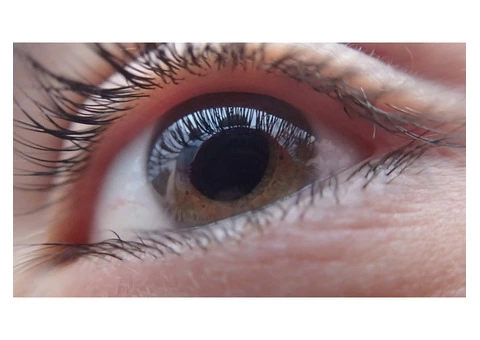 Does What You Eat Impact On Cataracts Know With Adelaide Eye Surgeons